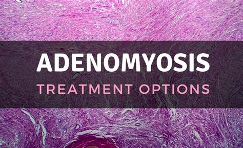 Adenomyosis Symptoms Treatment Options And More