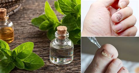 Oregano Oil For Nail Fungus Benefits And Usage Castor Oil Guide