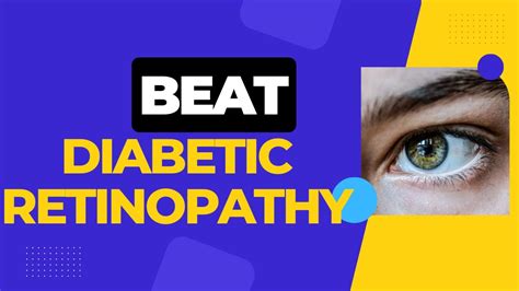 Preventing Diabetic Retinopathy Causes Symptoms And Strategies For