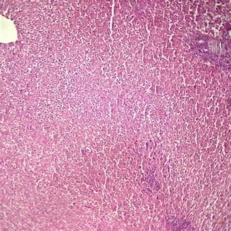 Histopathological Sections Of Rabbits Liver In Group A At 7 Days Post