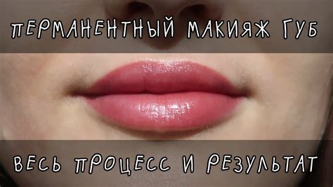 Процесс заживления перманентного макияжа губ фото