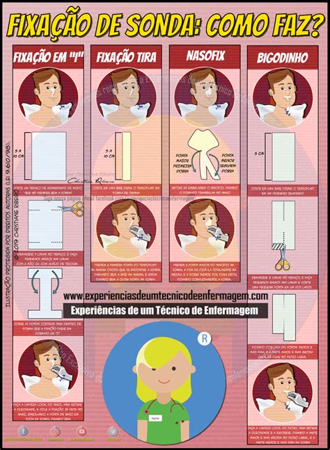 Como Faz Uma Fixa O De Sonda Enteral Ou G Strica Study Organization