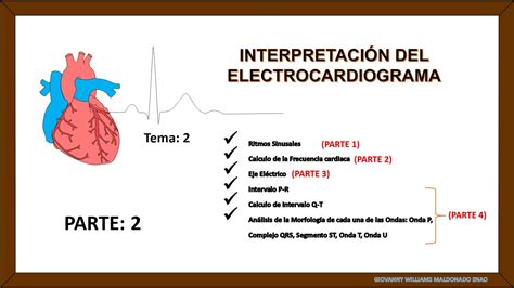 Tema 2 Interpretación Del Electrocardiograma Parte 2 Frecuencia Cardiaca Youtube