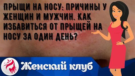 Прыщи на носу: причины у женщин и мужчин. Как избавиться от прыщей на ...