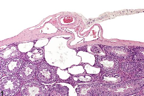 Testis Rete Dilation Nonneoplastic Lesion Atlas