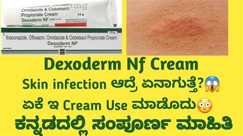 Dexoderm Nf Cream Information In Kannada Uses Side Effects Safety