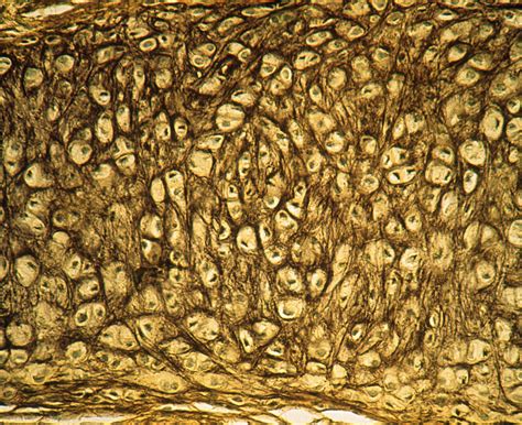 Elastic Cartilage Connective Tissue