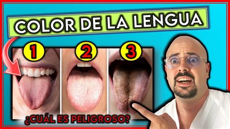 Qu Significa El Color De Tu Lengua Cu L Indica Enfermedad Grave