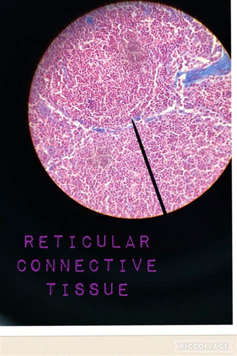 Reticular Connective Tissue Loose Connective Tissue Human Anatomy