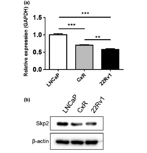 S Phase Kinase Associated Protein 2 Skp2 Expression In Prostate