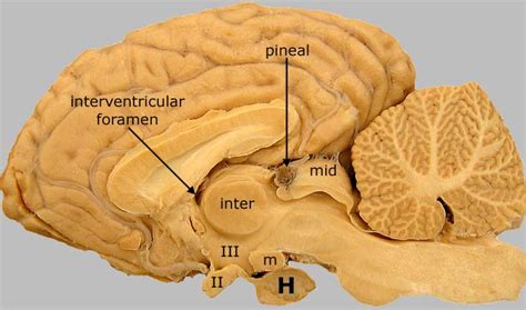 Equine Brain Median View