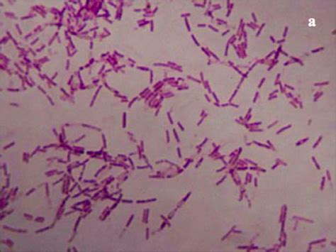 Sa Defenza Scienziato Russo Si Inietta Batteri Di Vita Eterna