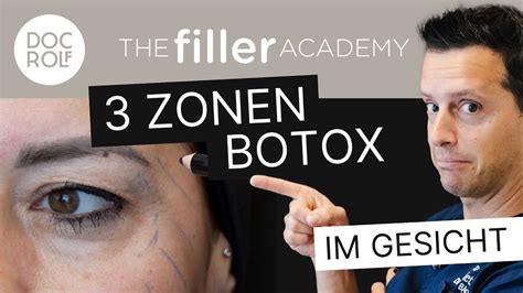 BOTOX SPRITZEN LERNEN Stirn Zornesfalten Krähenfüsse TFA by doc