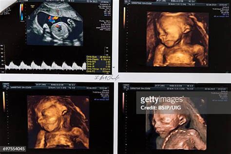 187 Ultrasound 8 Months Stock Photos, High-Res Pictures, and Images ...