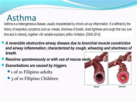 Asthma Copd Overlap Syndrome Acos Ppt