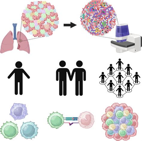 Spatial Multiplexed Immunofluorescence Analysis Reveals Coordinated