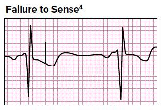 Transcutaneous Pacing - Code One CPR Training