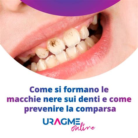 Come Si Formano Le Macchie Nere Sui Denti Scopriamo Insieme