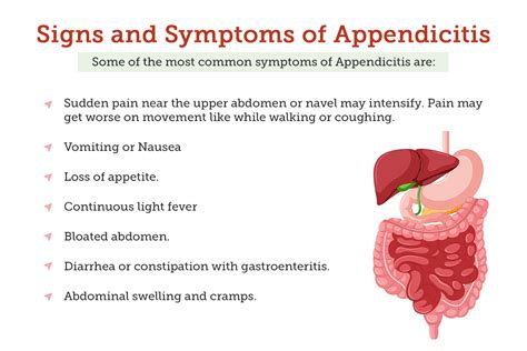 Appendicitis Types Signs And Symptoms Causes Risk Factors 55 OFF