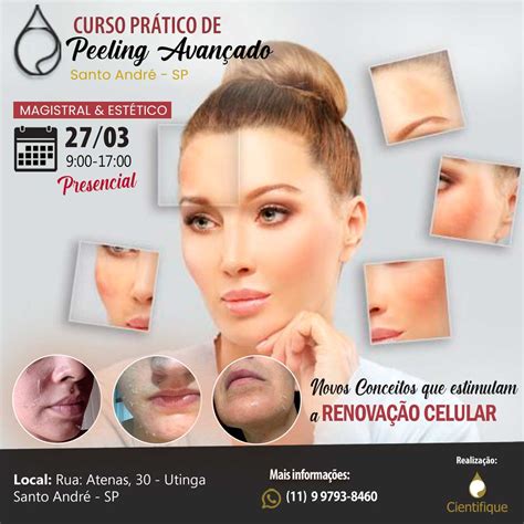 Inscri O Curso Pr Tico De Peeling Avan Ado Cientifique