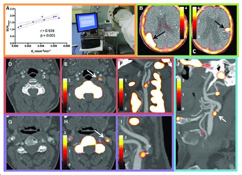 Dynamic positron emission tomography (PET) acquisition and examples of ...