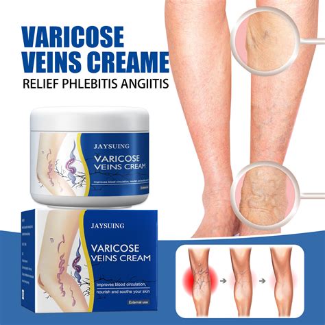 Vein Cream Relief Leg Pain Spider Veins Vasculitis Promote Circulation Smooth Metabolism 30g