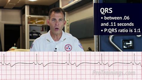 Bradycardia (ECG Rhythm Interpretation) - YouTube