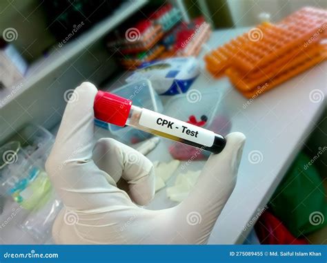 Creatine Phosphokinase CPK Enzyme Test With Laboratory Background