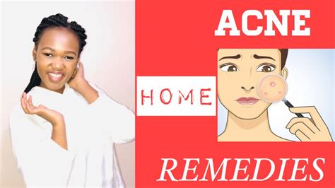 Acnes Management With Home Remedy 😊and Treatment🙌🏻 Nina Gichunji