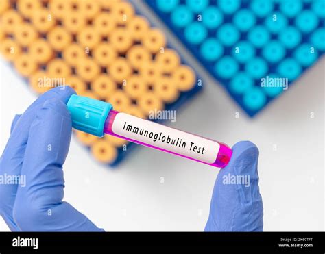 Immunoglobulin A or IgA level diagnosis for immunodeficiency disease ...