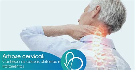 Artrose Cervical Conhe A As Causas Sintomas E Tratamentos Fisio