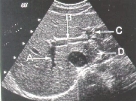 INTRO TO SONOGRAPHY II Diagram Quizlet