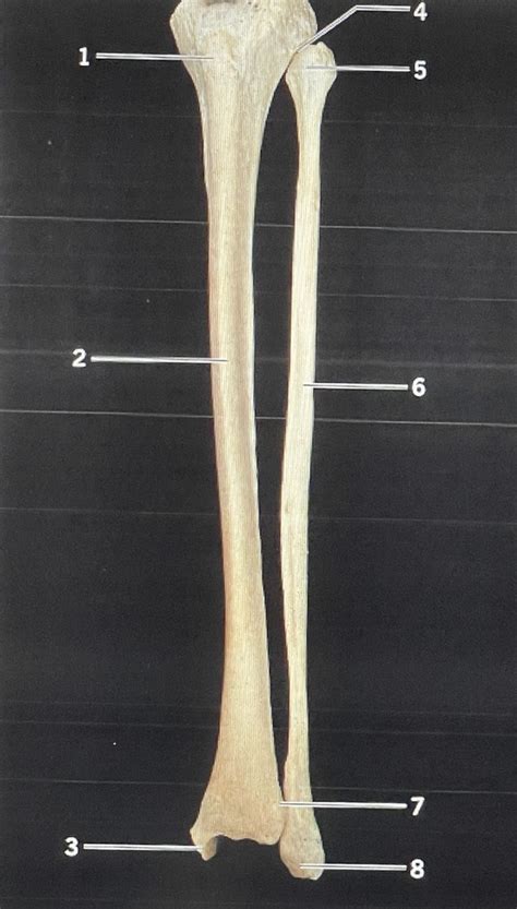 Left Articulated Tibia And Fibula Anterior View Diagram Quizlet