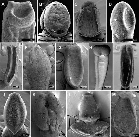 Scanning Electron Micrographs Of Scoleces Of Bothriocephalidean Download Scientific Diagram