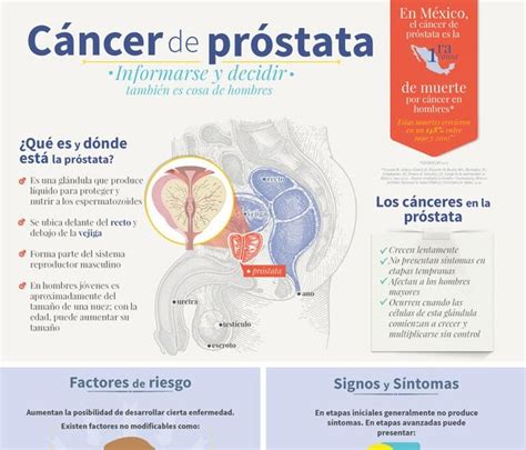 Excelente Infografía Para Entender Como Tratar Y Prevenir El Cancer De