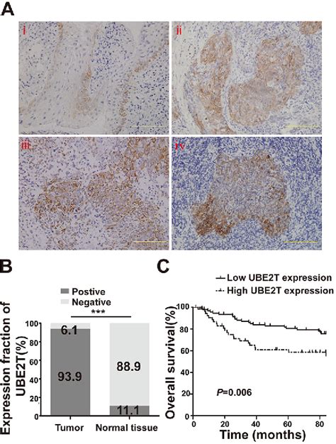 Figure 1 From Ube2t Promotes Nasopharyngeal Carcinoma Cell