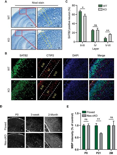 Abnormal Brain Development Of Ash L Knockout Mice A Nissl Staining