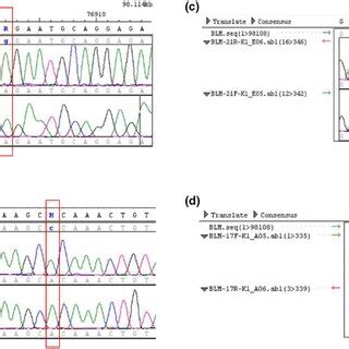 Electropherogram Of Sanger Analysis Of Patient K1 Demonstrating A