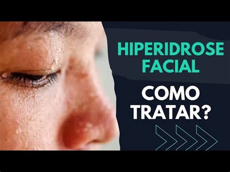 HIPERIDROSE FACIAL SUOR EXCESSIVO NO ROSTO COMO TRATAR SAIBA