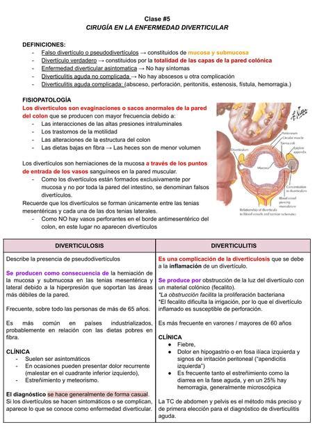 Enfermedad Diverticular MEDilove UDocz