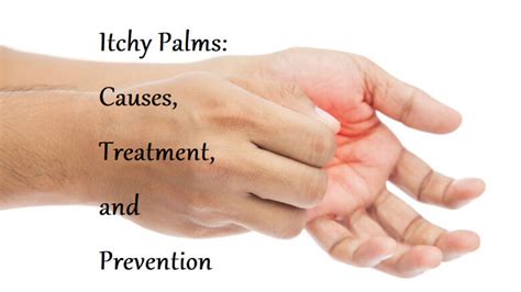 Itchy Palms: Causes, Treatment, and Prevention - LearningJoan