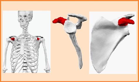 Apófisis coracoides características función trastornos