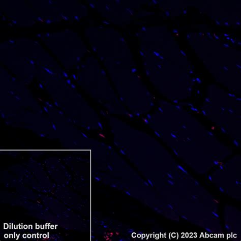 Recombinant Alexa Fluor Anti Interferon Gamma Antibody Epr