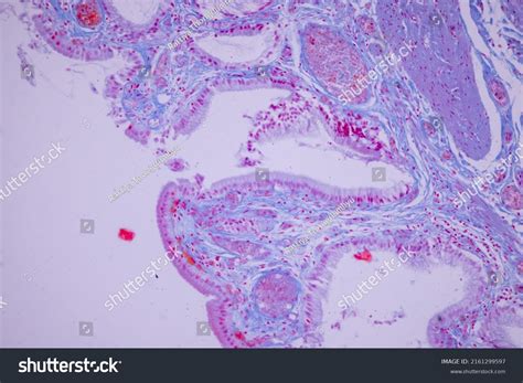 Columnar Epithelium Human Gall Bladder Under Stock Photo 2161299597