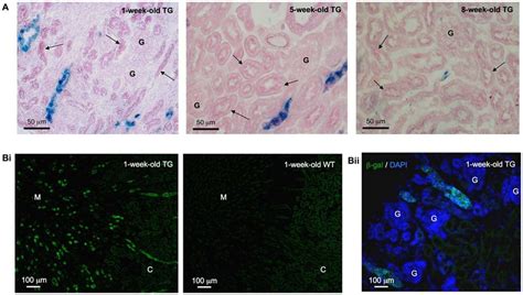 X-gal assay and b-galactosidase (b-gal) immunohistochemistry. A. X-gal ...