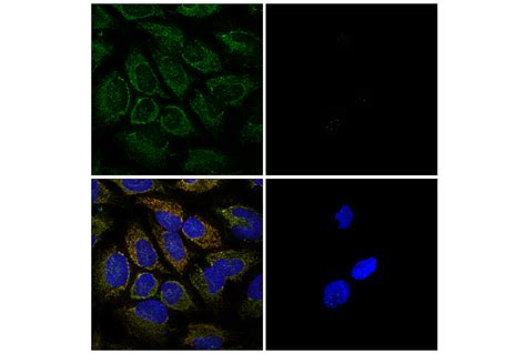 TIM23 E1Q7L Rabbit MAb Cell Signaling Technology