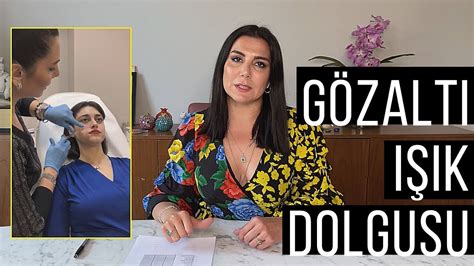 GÖZALTI IŞIK DOLGUSU UYGULAMASI Morluklar Çukurlar Op Dr