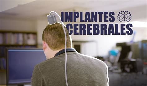 ¿qué Hay Detrás De Los Implantes Cerebrales Unam Global