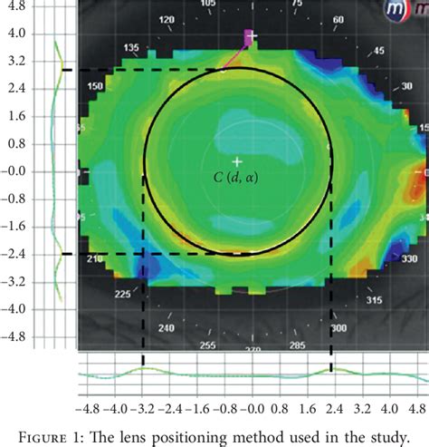 Figure 1 From Comparison Of Toric And Spherical Orthokeratology Lenses