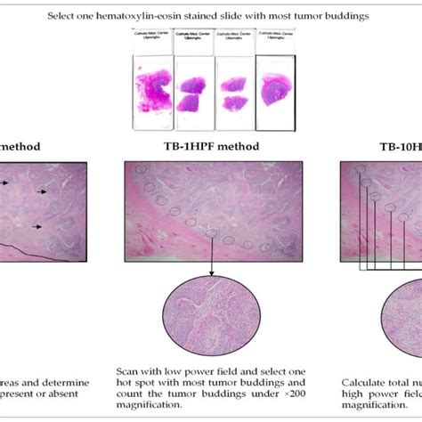 Summary Of A Meta Analysis Evaluating The Relationship Of Tumor Budding